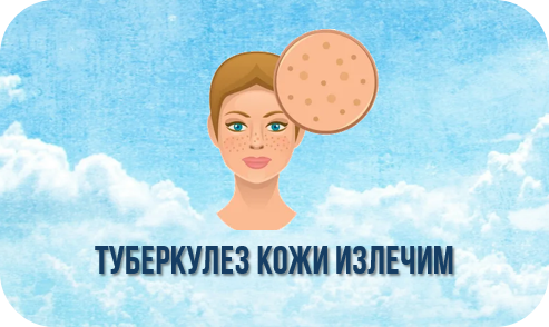 Туберкулез кожи излечим Туберкулез кожи излечим.